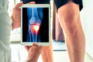 absurd healthcare claims charges for 850 knee x-rays